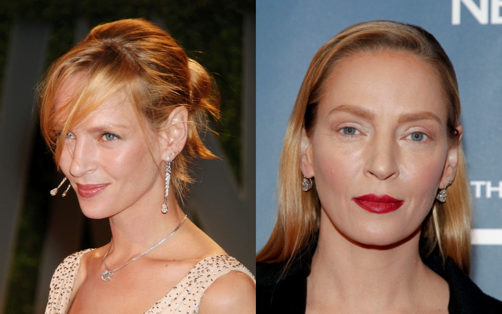 Uma Thurman nueva imagen tras operacion